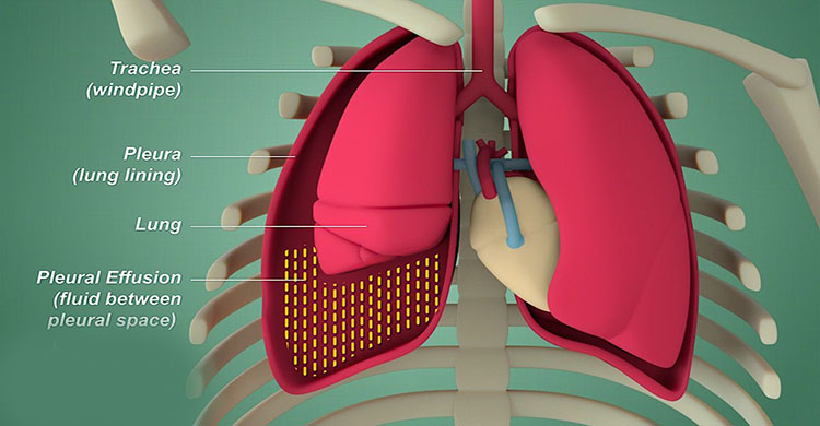 Best Lung Speciality in Faridabad