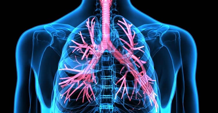 Bronchiectasis Treatment in Faridabad